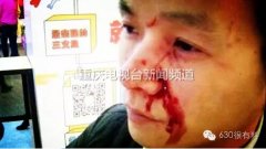 男子超市遇人插队提醒后被打 儿子：是不是不该阻止