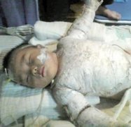 4岁男孩好想自由活动手指，你能帮帮他吗？