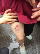 大学城一小区狗打架主人也打，主人都被咬伤