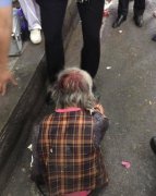  重庆83岁老太头部摔伤 热心市民出手相助