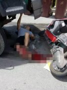 男子被货车压断腿  货车司机：我怎么陪得起