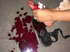 小黄车突然倒地 砸伤散步的女子血流一地