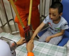 孩子误把螺帽当戒指戴 取不出来急坏父母