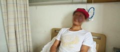 男子脸上长出巨大血管瘤 血液喷涌而出