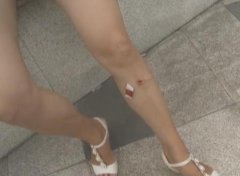这桩子安得不醒目 本意是防车不料却伤了人