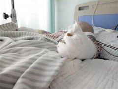 一岁男孩双手伸进汤锅 医生：可能影响手指功能