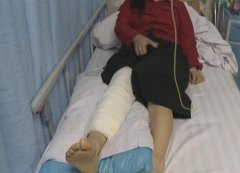 女子被步行街上的“绊马索”绊倒摔骨折
