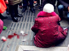 大妈广场上摔了一地血 多人围观无人敢扶
