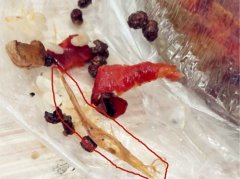 女子点外卖吃鸡杂 先后吃出两根鸡毛