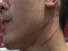 因为不让看手机 小夫妻互殴还叫来警察